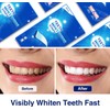 Whitening Strips Bleaching Teeth Stripes: MrDoggy Whitening Stripes, Teeth Whitening