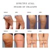 Gel Crema Perder Peso Abdomen Grasa Adelgazar Celulitis Neutra