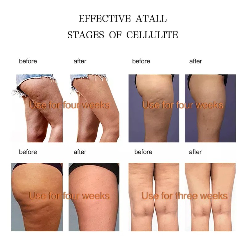 Gel Crema Perder Peso Abdomen Grasa Adelgazar Celulitis Neutra