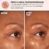 Advanced Microdermabrasion Face Exfoliator by Dr. Brandt for Unisex -