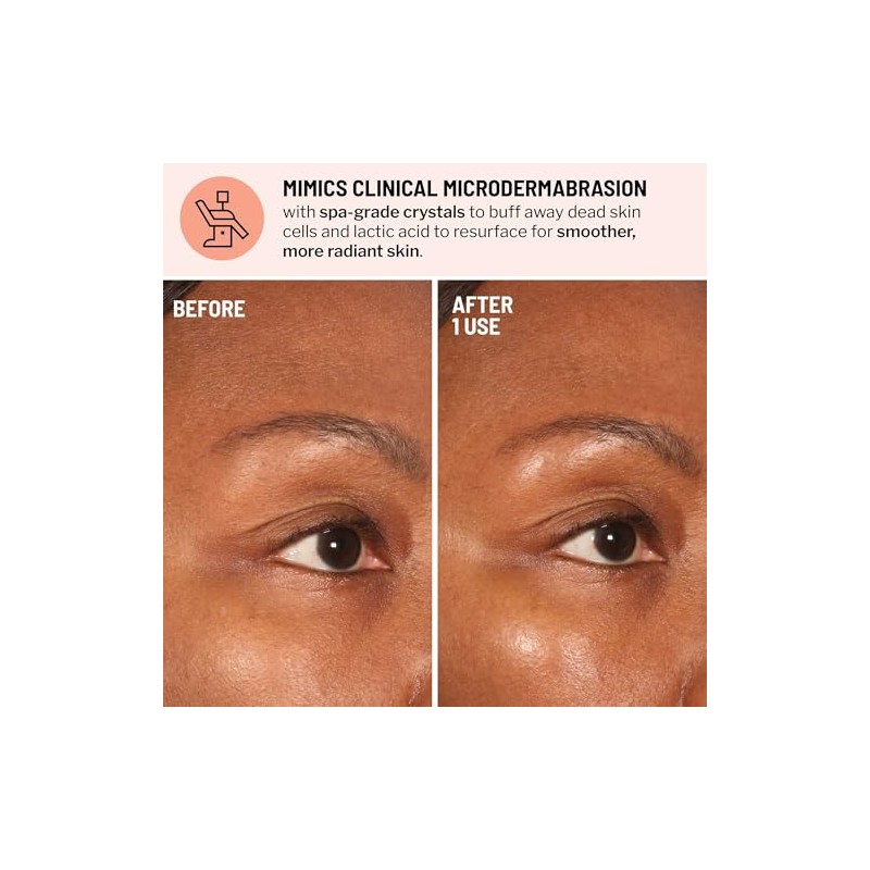 Advanced Microdermabrasion Face Exfoliator by Dr. Brandt for Unisex -