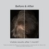 Isdin Loci?n Lambdapil para Fortalecer el Cabello Contra