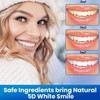 Teeth Whitening Strips, Tooth Whitening Kits, at Home Teeth whitening