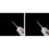 Dentrix SonicPulse ControlShot Oral Irrigator
