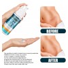 Crema Gel Reparadora Cicatrices Acné Jaysuing 50 Ml Estrías