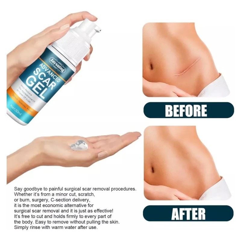 Crema Gel Reparadora Cicatrices Acné Jaysuing 50 Ml Estrías