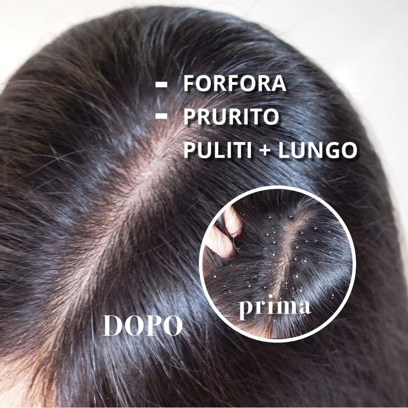 Maternatura Anti Dandruff Scalp Scrub with Tea Tree 250g