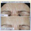 Roc Hydration+ Hidratante Con Fps 30 + Crema De Ojos