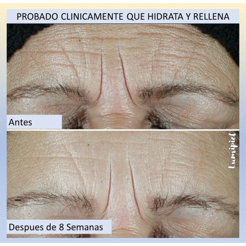 Roc Hydration+ Hidratante Con Fps 30 + Crema De Ojos