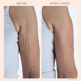 BODY FIRM - Tratamiento de reparacin corporal de crep con borrado, crema antienvejecimiento, soporte para pieles de elastina natural y produccin de...
