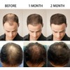 PURC Hair Growth Essence Oil Hair Loss Treatment Help for