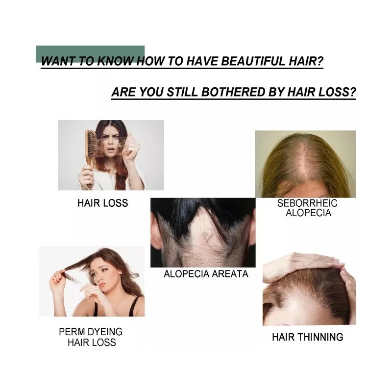 Tratamiento Para Exceso Caida Cabello Mujer Fortalece 30ml