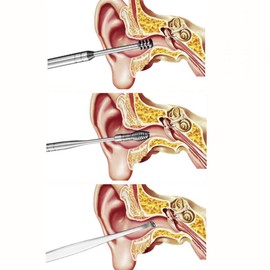 JZK JZK 5 pcs Ear Cleaner Stainless-Steel Set with box, Ear wax Curette, Ear Cleaning Tool, Stainless Steel Ear wax Remover spiral, Professional Ear Cleaner Set with Storage (Silver)