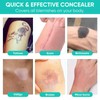 iTecFreely Tattoo-Cover-Up Sweatproof-Waterproof-Tattoo-Cover-Up-Tape Ultra-Thin-Invisible-Breathable-Patch-Concealer-Sticker-Suitable-for-Spot-and-Scar