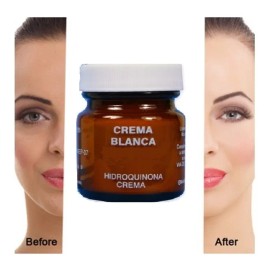 Crema Aclarante Y Quitamanchas Hidro !