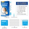 Plasma Pen Fibroblast Pen 9 intensidades Inalambrico