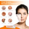 Strataderm Scar Therapy Gel 5g