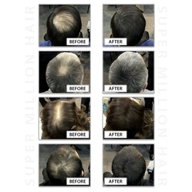 Super Million Hair - 1 x 25g Hair Building Fibres - No.13 Light Grey