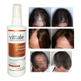 Kit Tratamiento Shampoo Y Locion Anticaida Vittale