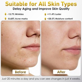 LED Face and Neck Mask, Ntyikul Red Light Mask Face with 7 Light Colours and 5 Brightness Levels, LED Face Mask with Remote Control, for All Skin Types, for Anti-Ageing, Brightens Skin Tone