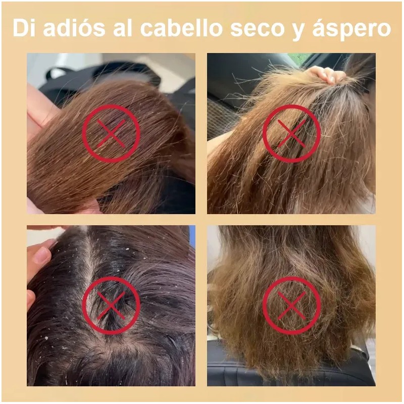Natural Shampoo De Jengibre El Crecimiento Del Cabello 240ml