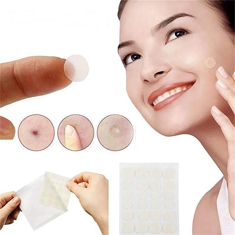 40 SOS Spot Anti Pimples, Anti Acne, Hypoallergenic Plasters with