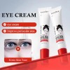 Crema De Ojos Blanqueadora Y Eliminadora De Manchas Con Ácid
