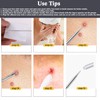 YMCCOOL Blackhead Remover Tool Kit,12Pcs Pimple Popper Comedone Extractor Tool