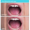 Fake Tooth Repair Kits DIY Dental Care Kit Glue for