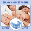 Snoring Splint, Anti Snoring Stopper, Anti Snoring Snoring Stopper, Mouth