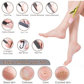Set Pedicura Lima para pies de acero inoxidable, Raspador de callos, Cortauñas, Herramientas profesionales para eliminar piel muerta, Cuidado de pies para hombres y mujeres