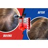 FIRE FIBRE Hair Fibres for Thinning Hair Undetectable & Natural