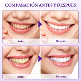 Tiras Blanqueadoras de Dientes, Whitening Strips, Bandas Dentales Blanqueadoras, Blanqueador de Dientes, Cinta Blanqueadoras de Dientes, Blanquear Dientes y Eliminar Manchas (14)