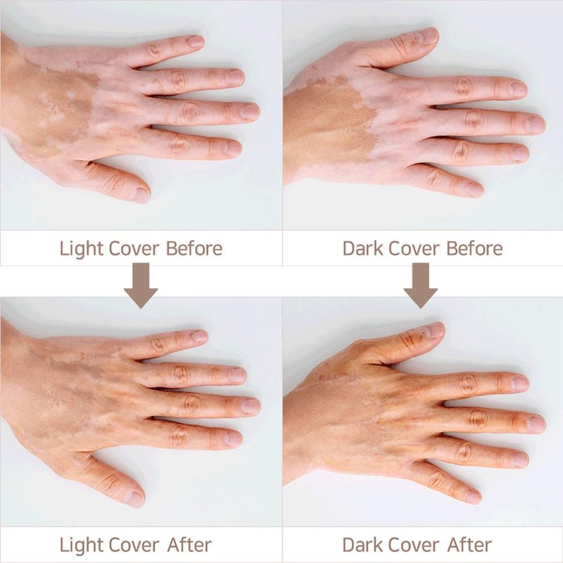 MELAFIL 白斑 防水 カバー メイク コンシーラー リキッド 韓国製 レディース メンズ