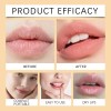 Bálsamo Labial Con Protección Solar Spf50, Uva, Uvb, Hidrata
