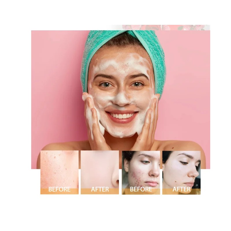 US Store Turmeric Liquid Face Cleanser Pore-Shrinking Deep Cleansing Moisturizernet