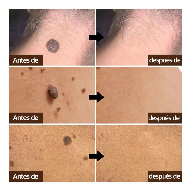 Crema Reparadora Profesional Para Todo Pieles