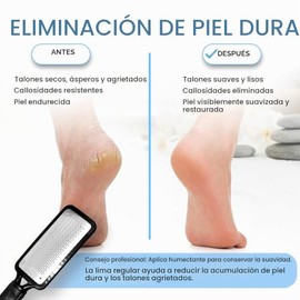 Colossal Foot Rasp Foot File And Callus Remover, Best Foot Care Pedicure Metal Surface Tool To Remove Hard Skin, Can Be Used On Both Wet And Dry Feet,