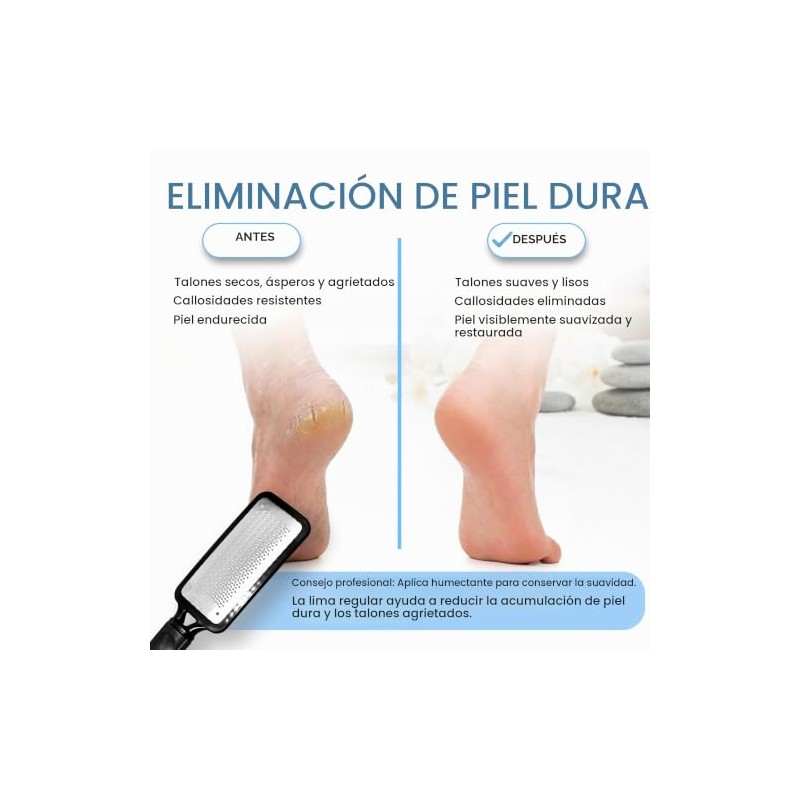 Colossal Foot Rasp Foot File And Callus Remover, Best Foot