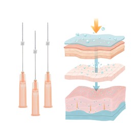 BYPPDO PDO Screw Threads, For Body and Face Lifting and Skin Improvement PDO Threads (20PCS-29G*50MM)