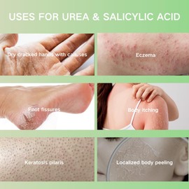 Urea Cream 40 Percent,Urea Foot&Hand Cream for Cracked Heels and Dry Skin,2% Salicylic Acid Foot Moisturizer for Callus Remover Nourishes Soften for Feet Hands Knees Legs,40% Urea Lotion for Feet,150G