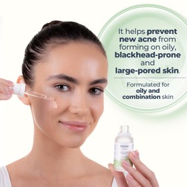 Zaroza Anti-Acne Serum – Salicylic Acid, Azelaic Acid & Niacinamide Formula – Clears Acne, Fights Breakouts, Balances Oily Skin & Fades Dark Spots – Vegan Face & Body Serum – 1 fl oz