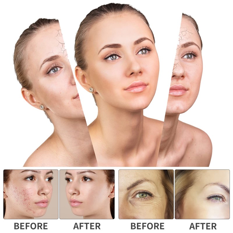 High frequency device, high frequency face machine with 6 neon