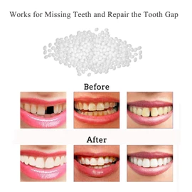 Tooth Repair Kit-Thermal Beads for Filling Fix The Missing and Broken Tooth or Adhesive The Denture Fake Teeth