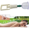 Itian 6 Cups Traditional Personal Care Chinese Medical Vacuum Body