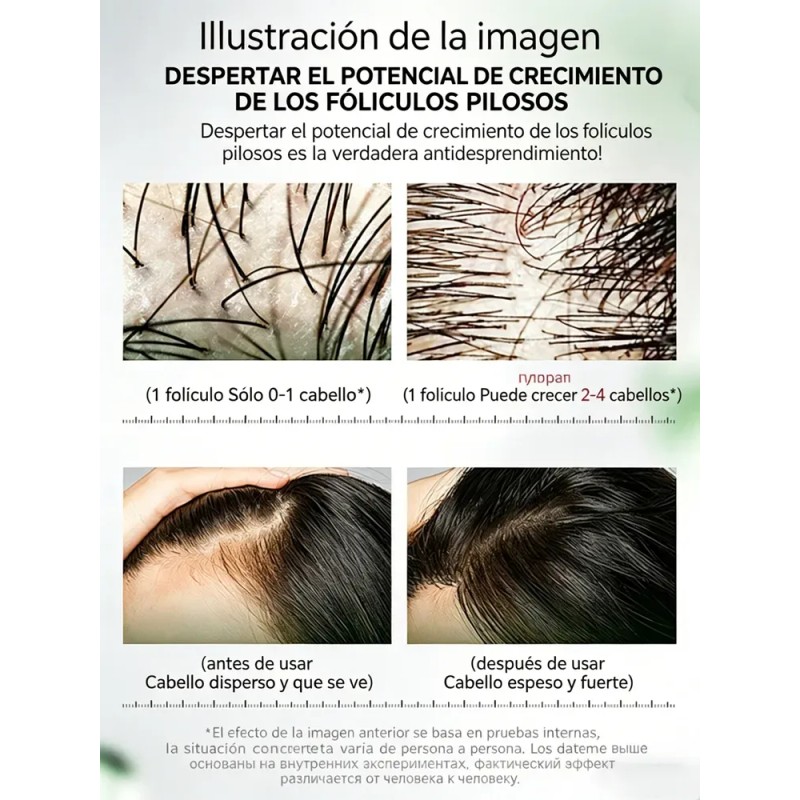 Sérum Crecimiento Cabello Calvicie Favorece Crecimiento 30ml