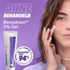 Benzaknen® 5% Gel for Acne in Mild to Medium Distinction,