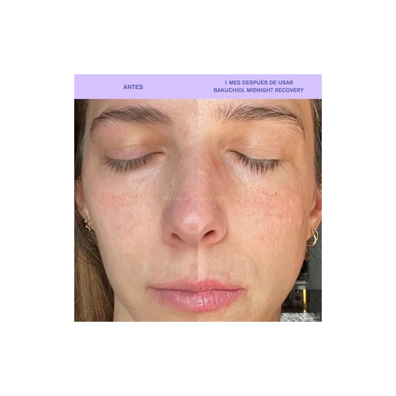 Blooms & Blends Cuidado de la Piel- Bakuchiol Midnight Recovery