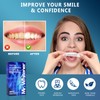 Mr.Whitener Teeth Whitening Strips (14 Strips)