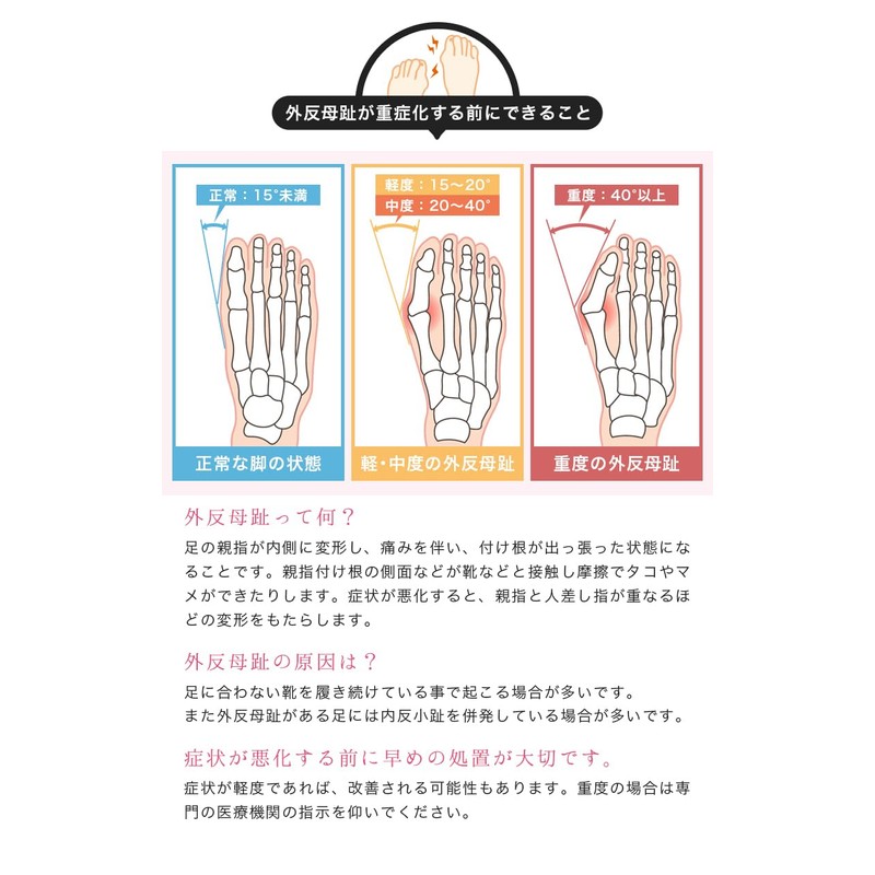 【T TrendMarche】 外反母趾 サポーター 足指サポーター 【 SEBS 簡単着脱 水洗いOK 左右兼用